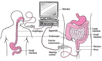 What are the types of endoscopy
