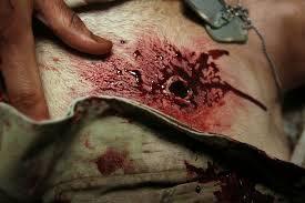 50 Cal Bullet Wound